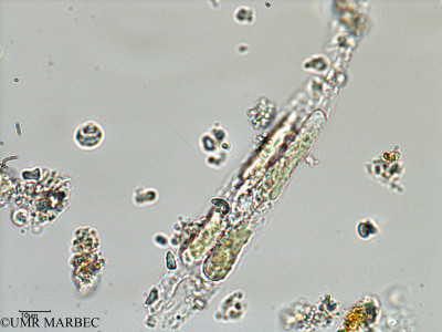 phyto/Bizerte/bizerte_lagoon/RISCO February 2015/Licmophora sp6 (ancien Lagune_T1-B_Licmophora sp6 -5).tif(copy)_thumb.jpg